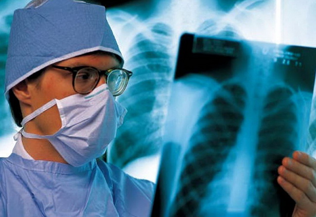 Update of the clinical protocol for the provision of medical care to patients with tuberculosis. Major changes